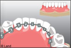 Orthodontie